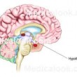 hypothalamus