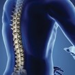osteoporosis