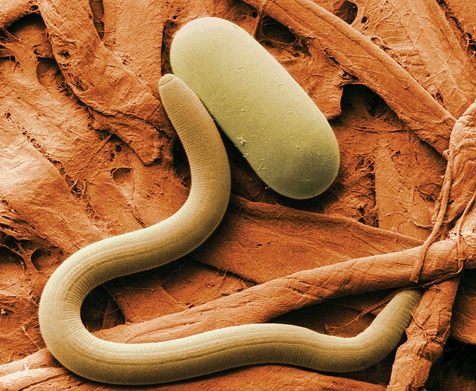 Nematodes_Roundworms