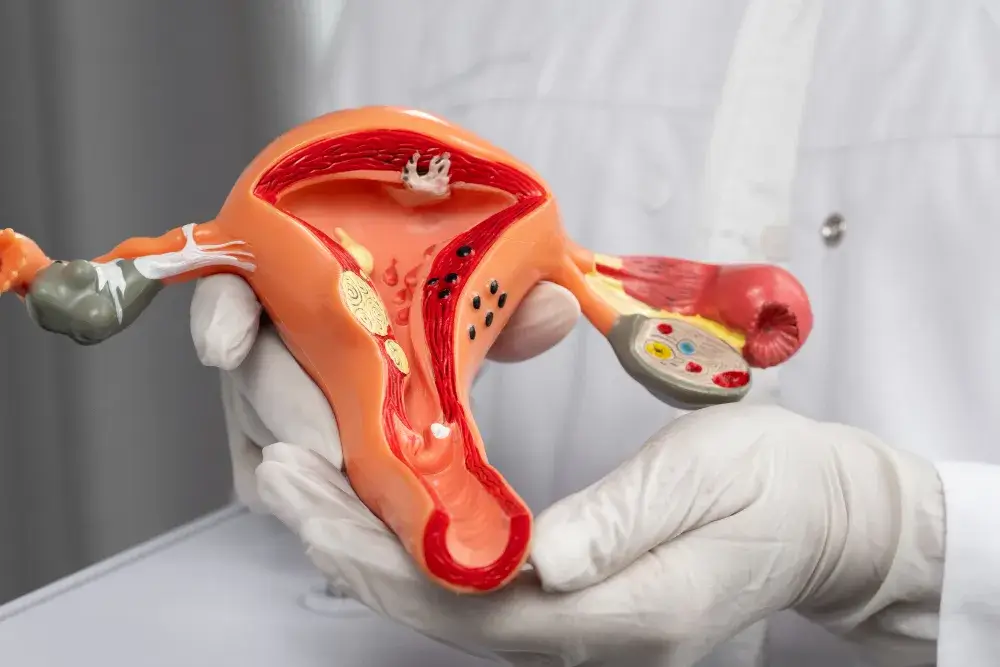 Structural Issues in Reproductive Organs