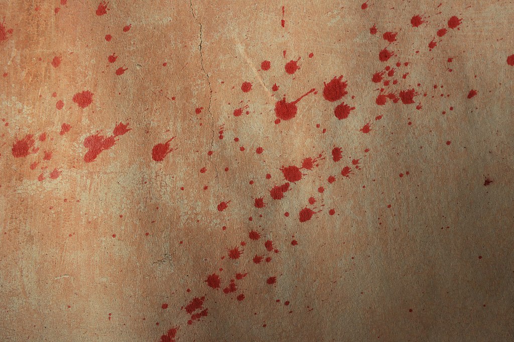 How to Choose the Right Blood Cleanup Company